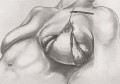 The History of Silicone Implants The History of Silicone Implants