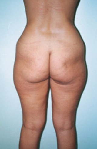 <span class="td">These photographs show a female patient before...</span>